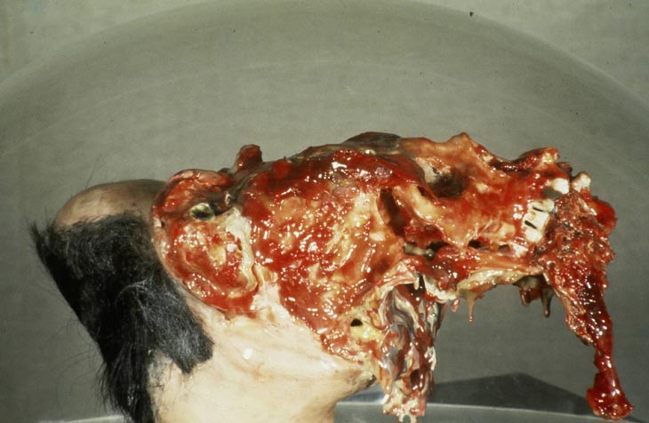 a. Mark Prent, His Final Statement, 1970